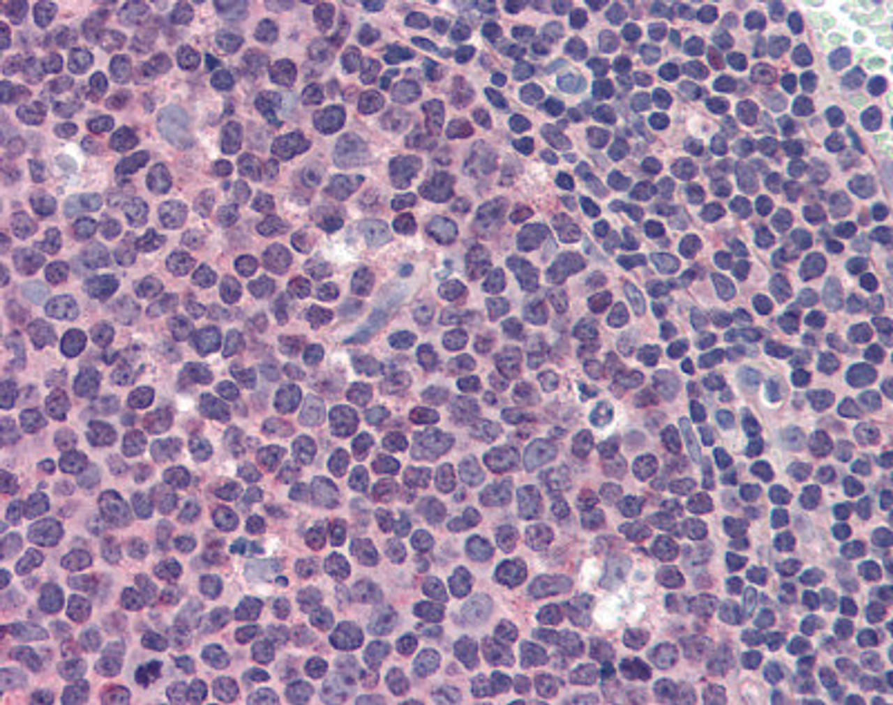 Immunohistochemistry staining of MCL1 in tonsil tissue using MCL1 monoclonal Antibody.