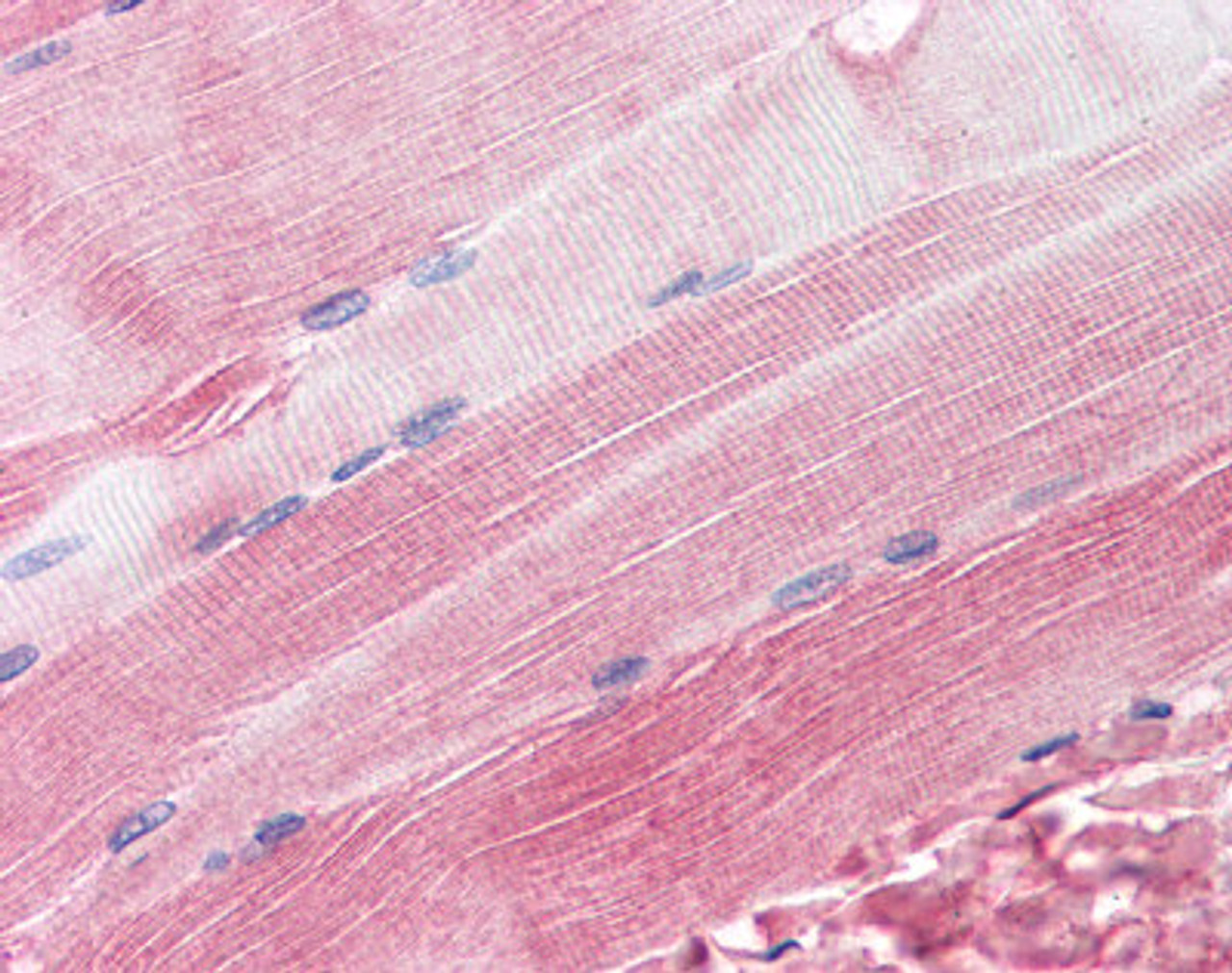 Immunohistochemistry staining of RAPSN in skeletal muscle tissue using RAPSN Antibody.