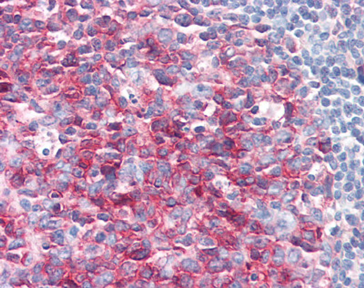 Immunohistochemistry staining of PAG1 in tonsil tissue using PAG1 Antibody.