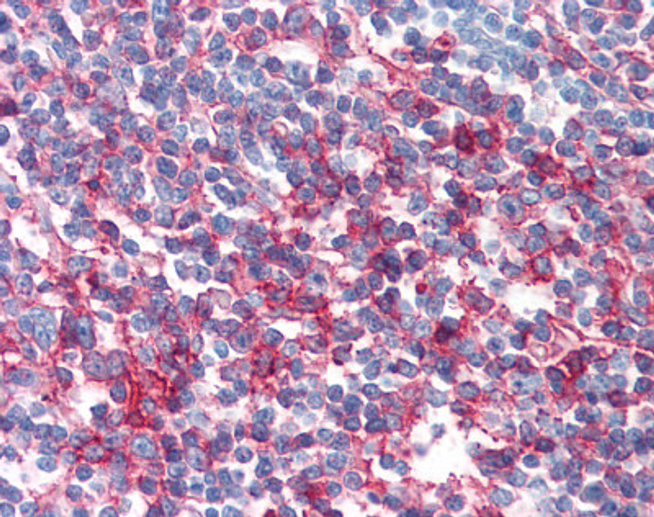 Immunohistochemistry staining of FAS in tonsil tissue using FAS monoclonal Antibody.