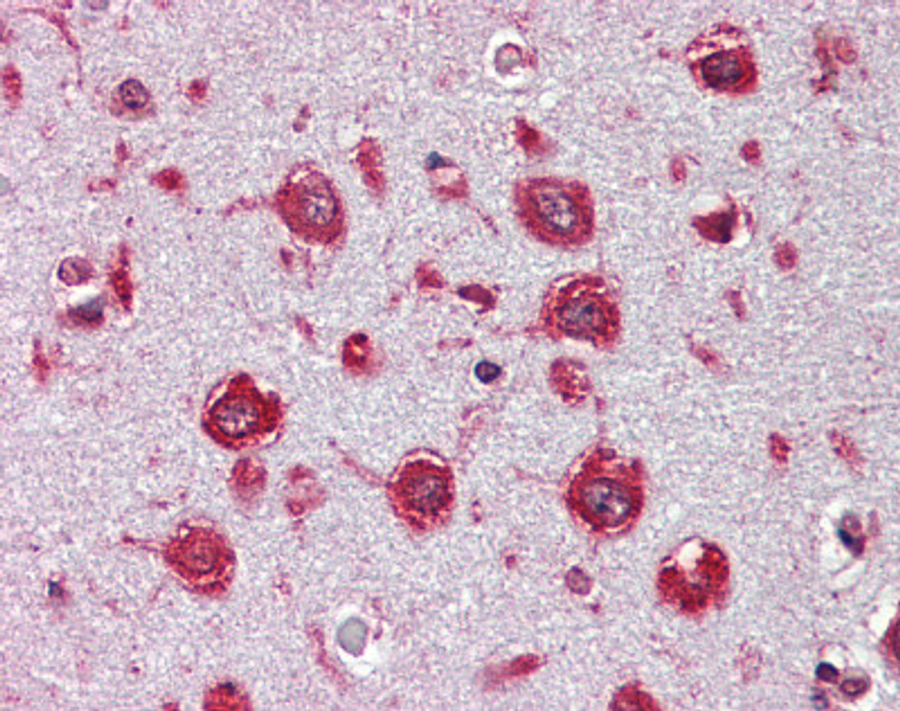 Immunohistochemistry of Human brain cortex tissue stained using Trypsin Monoclonal Antibody.