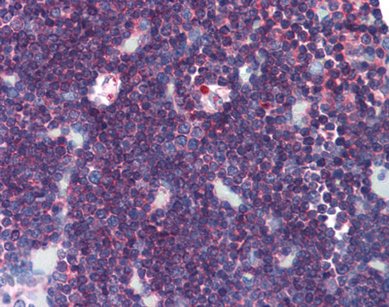 Immunohistochemistry of human thymus tissue stained using PTPRC Monoclonal Antibody.