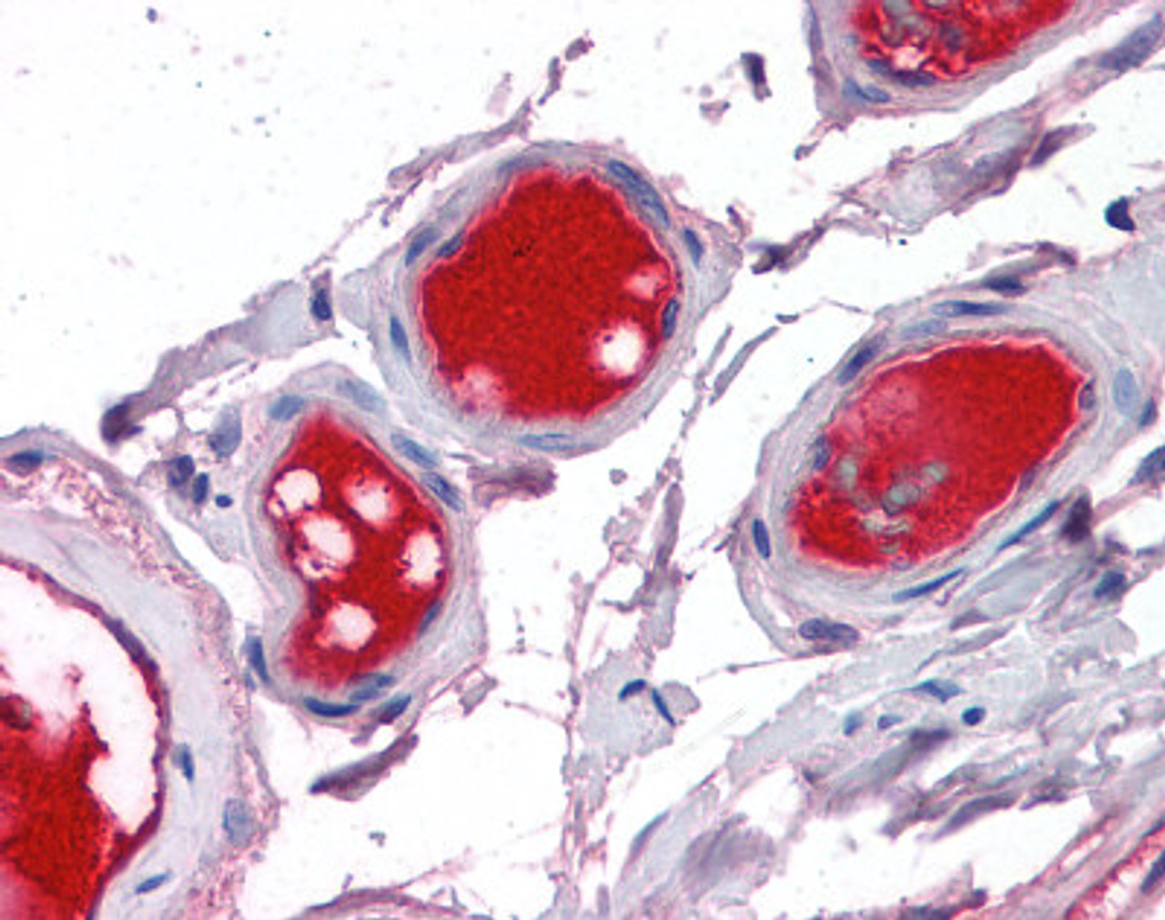 Immunohistochemistry of human small intestine vessels stained using Factor 10 Antibody.