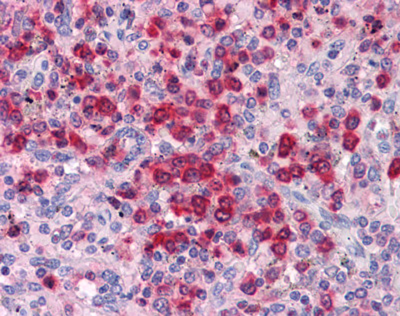 Immunohistochemistry of human speen tissue stained using ELANE Antibody.