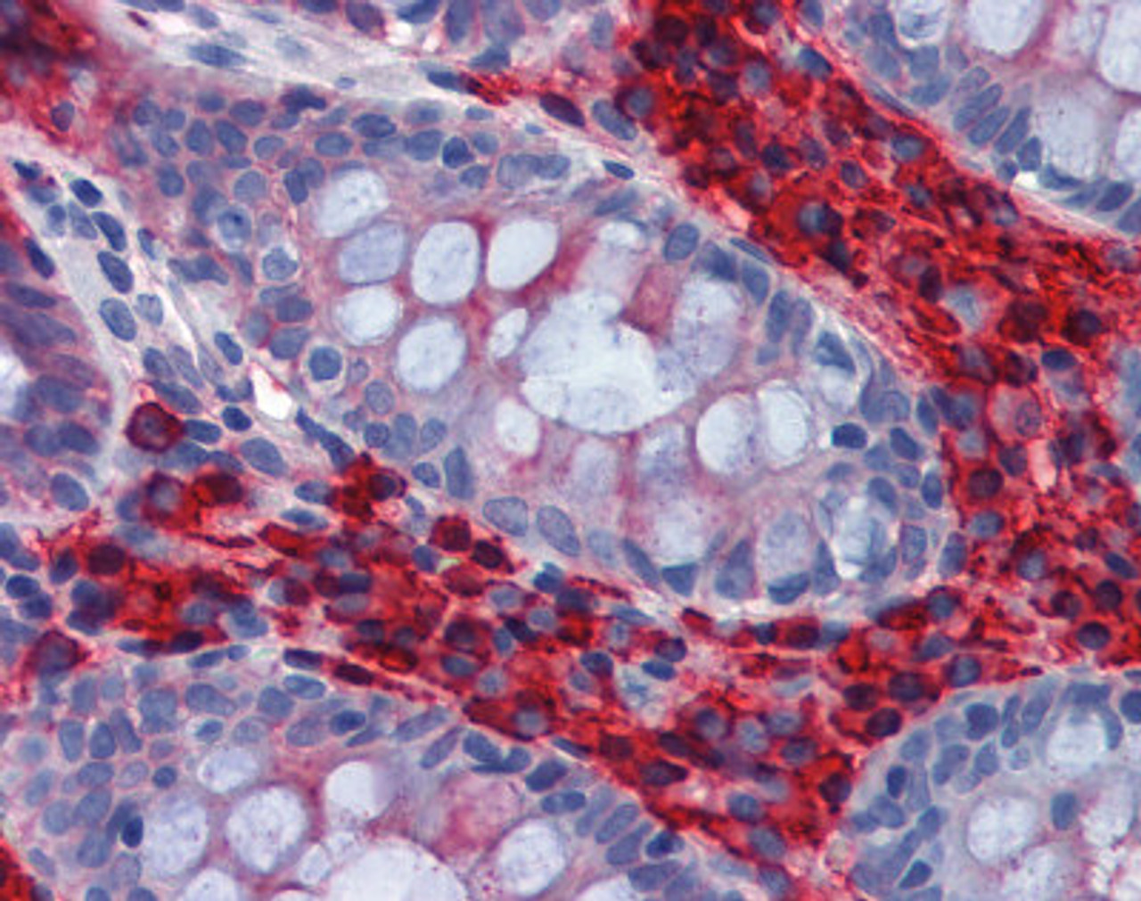Immunohistochemistry of human colon tissue stained using IgA Monoclonal Antibody.
