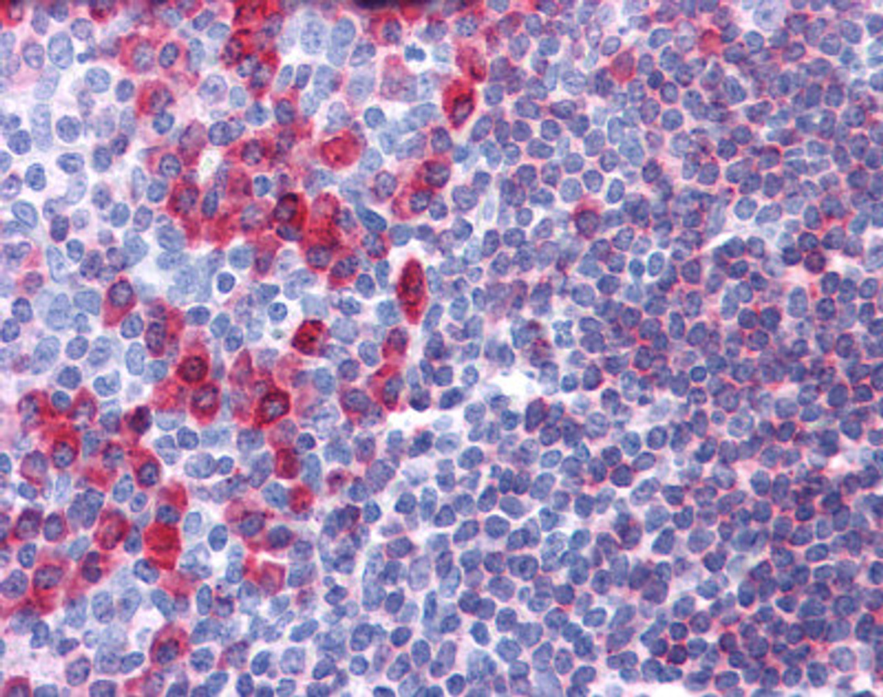 Immunohistochemistry of human tonsil tissue stained using CD79A Monoclonal Antibody.