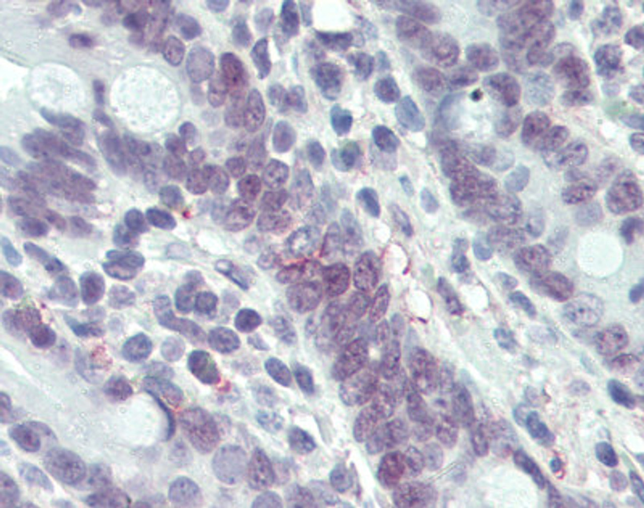 Human small intestine tissue stained with MLH1 Antibody, alkaline phosphatase-streptavidin and chromogen.