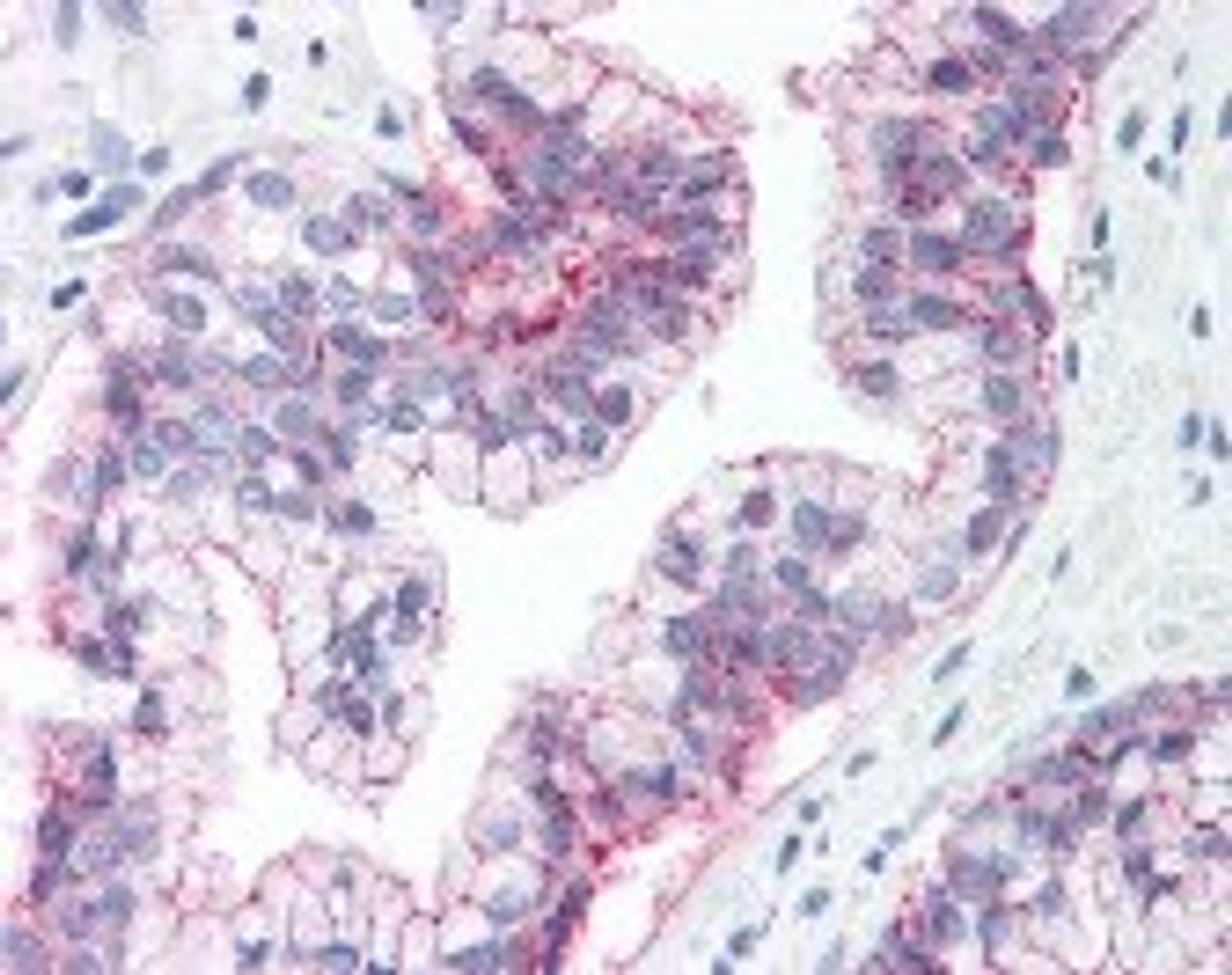 Immunohistochemistry staining of Claudin 3 in prostate tissue using Claudin 3 Antibody.