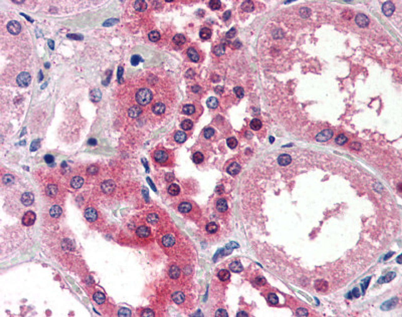 Immunohistochemistry staining of SMAD3 in kidney tissue using SMAD3 monoclonal Antibody.