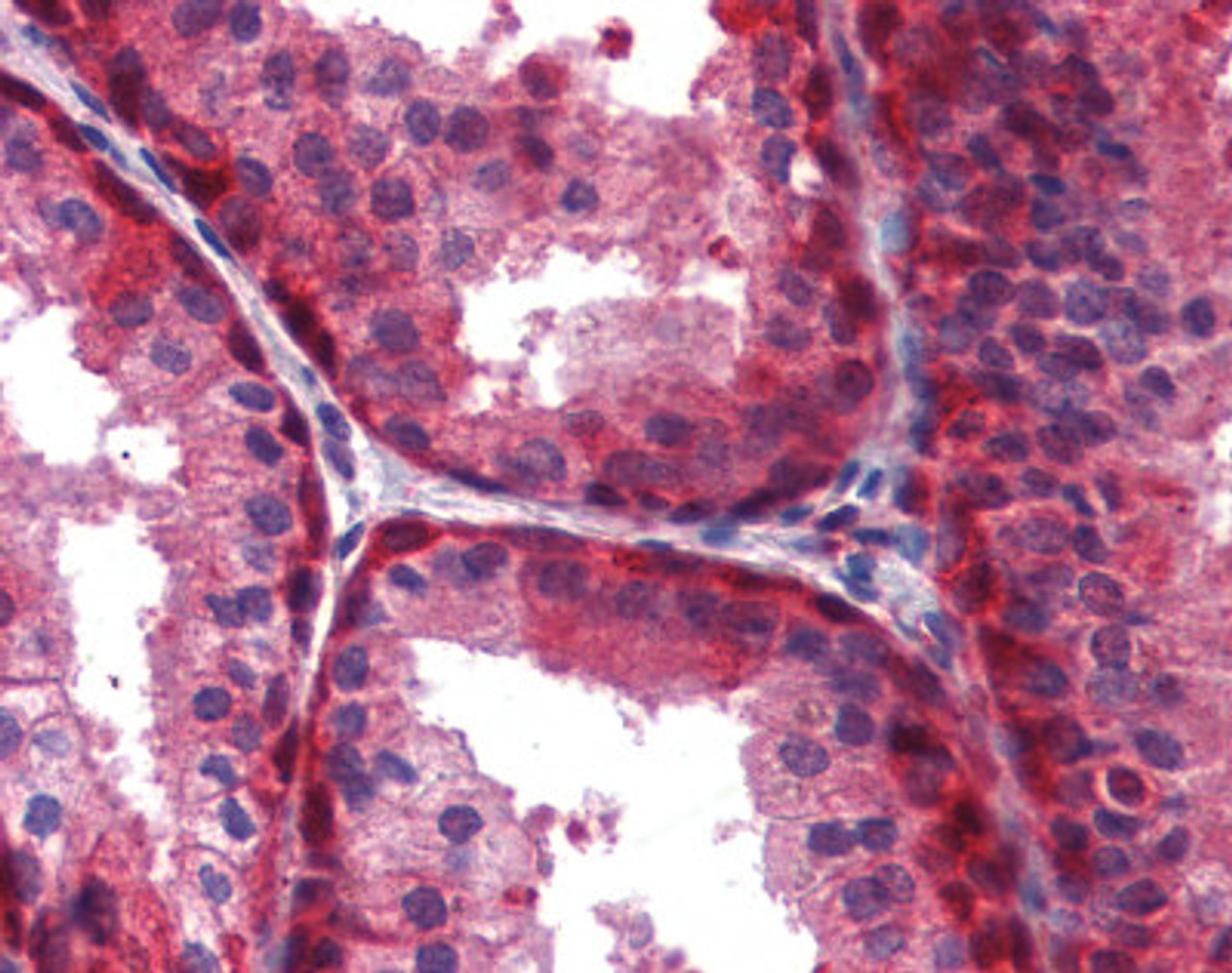 Immunohistochemistry of human prostate tissue stained using WNT5A Monoclonal Antibody.