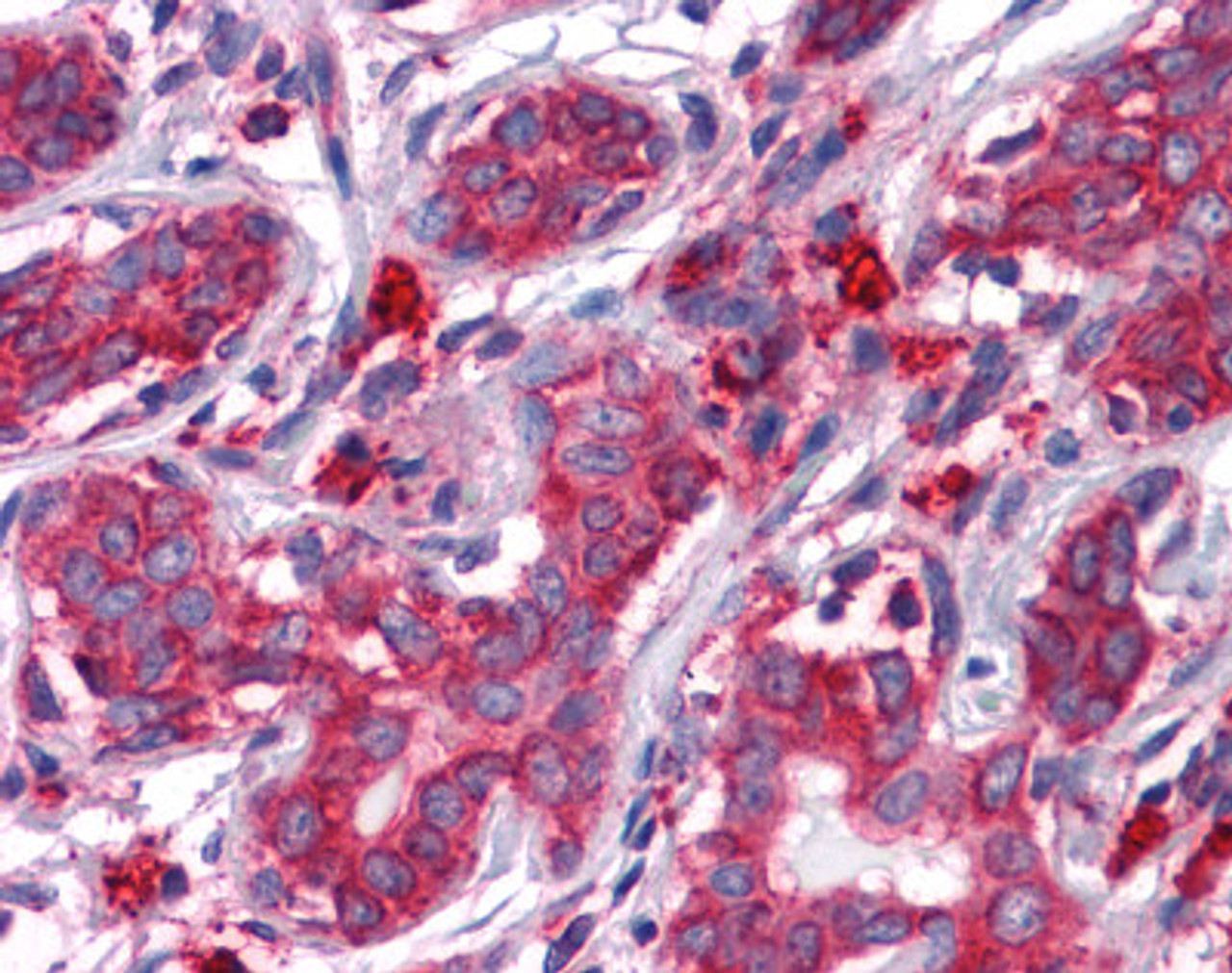 Immunohistochemistry of human breast tissue stained using GRP78 Monoclonal Antibody.