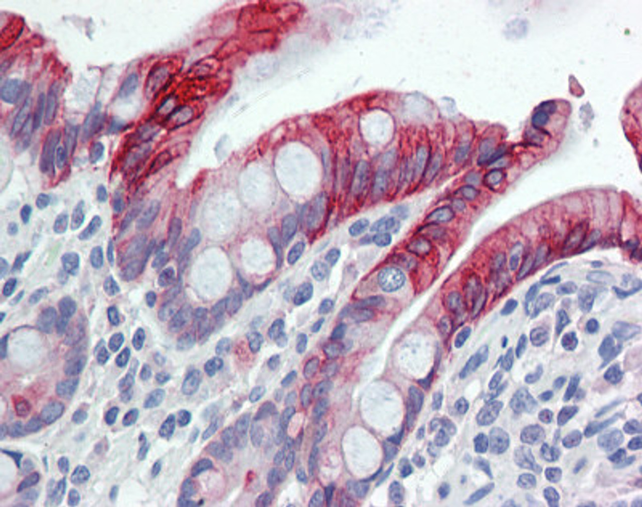 Immunohistochemistry of human small intestine tissue stained using Cytokeratin 20 Monoclonal Antibody.