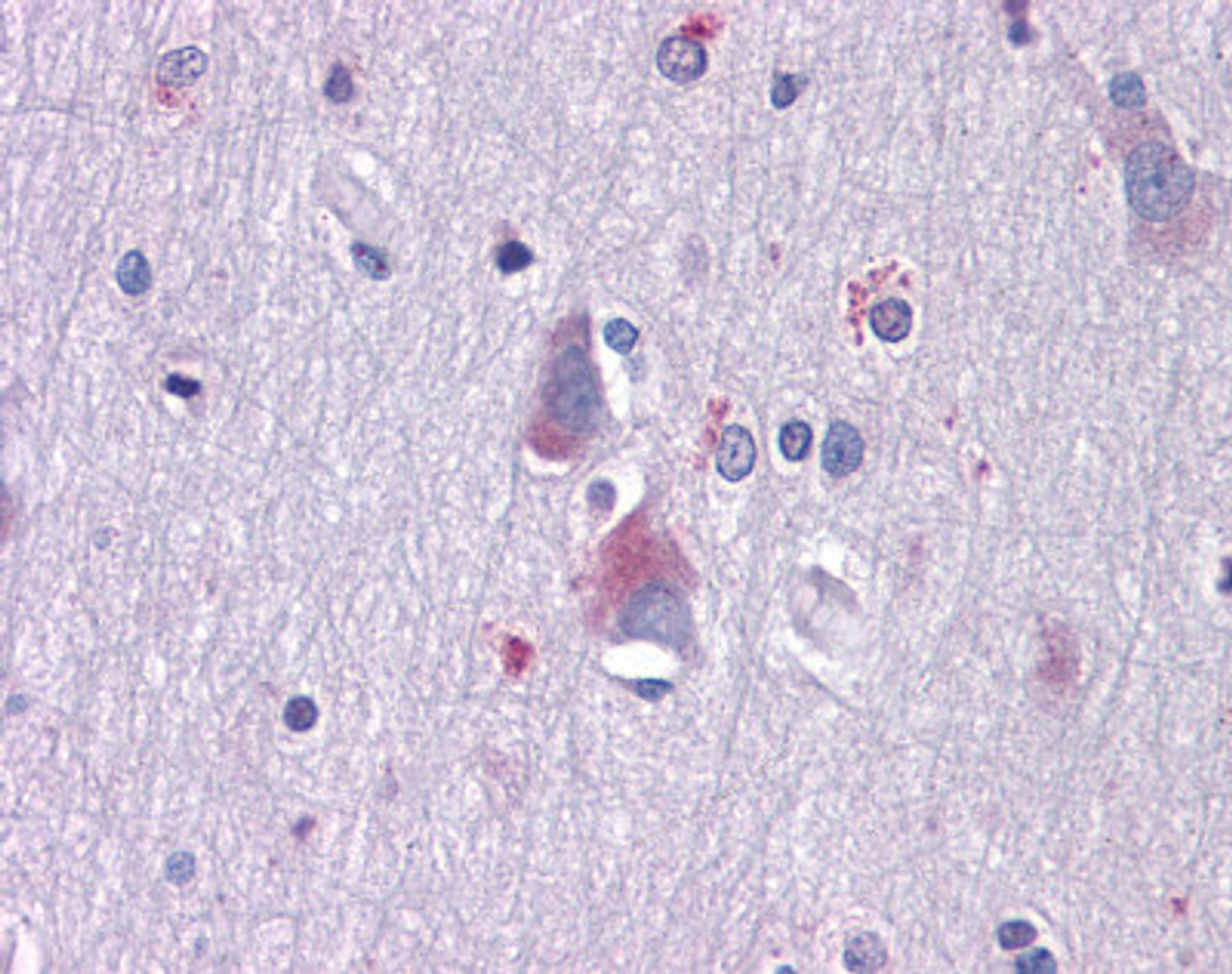 Immunohistochemistry of Human brain cortex tissue stained using AXL Monoclonal Antibody.