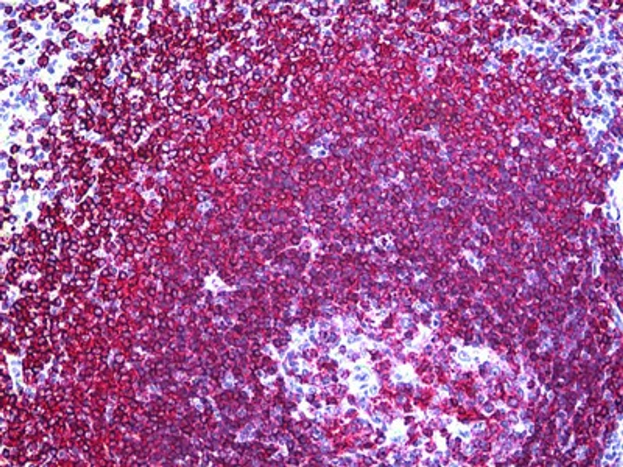 Immunohistochemistry of human spleen tissue stained using CD45RA Monoclonal Antibody.