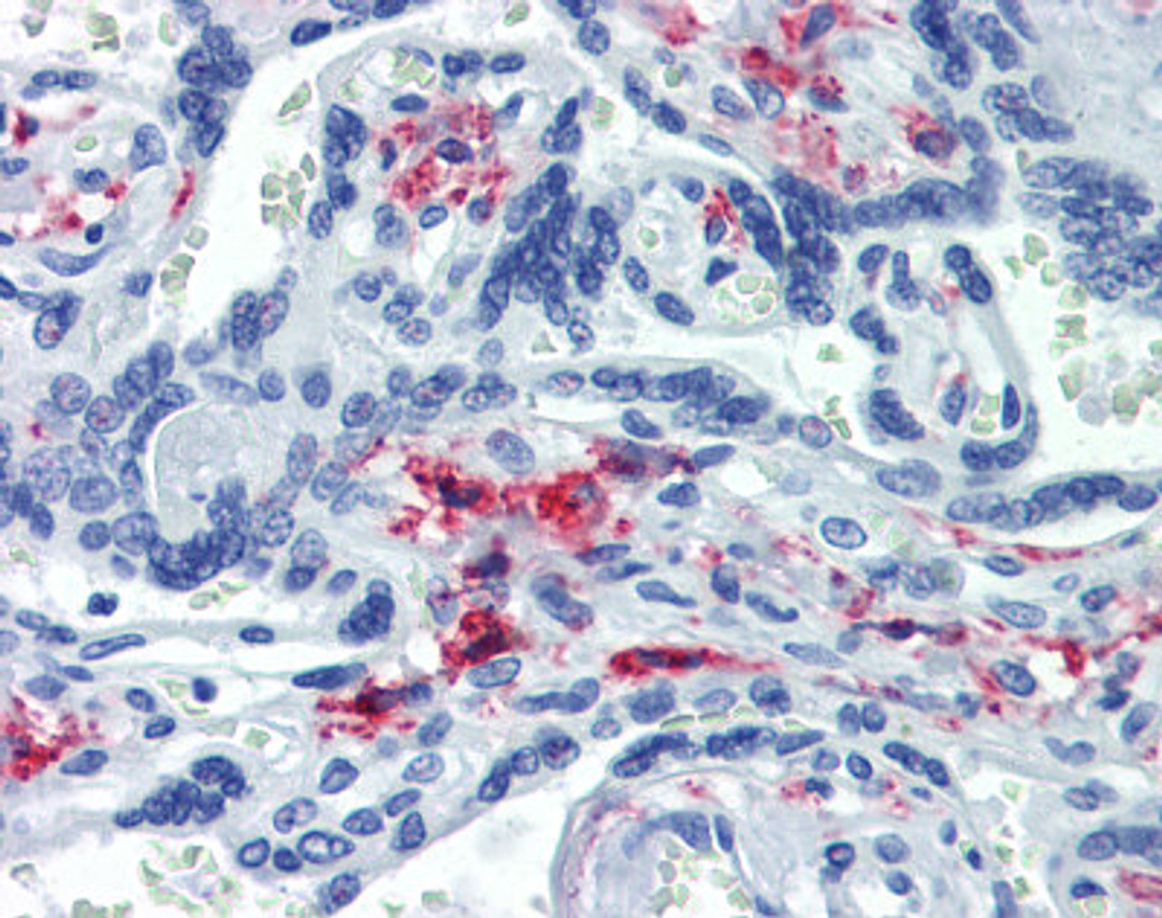 Immunohistochemistry of human placenta tissue stained using CD163 Monoclonal Antibody.