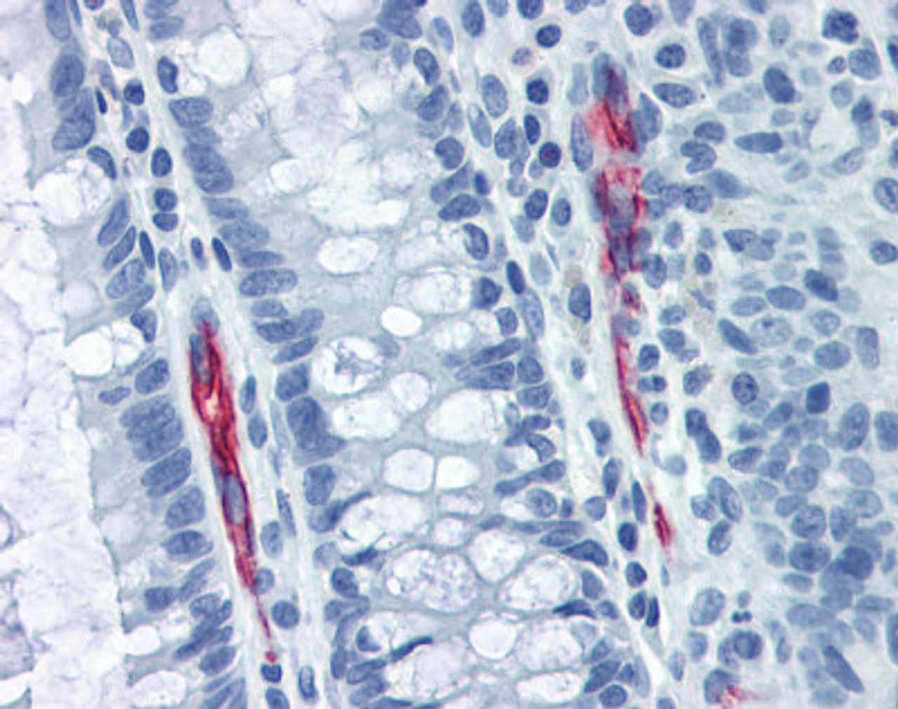 Human colon tissue stained with MADCAM1 Antibody at 10 &#956;g/mL followed by biotinylated anti-mouse IgG secondary antibody, alkaline phosphatase-streptavidin and chromogen.