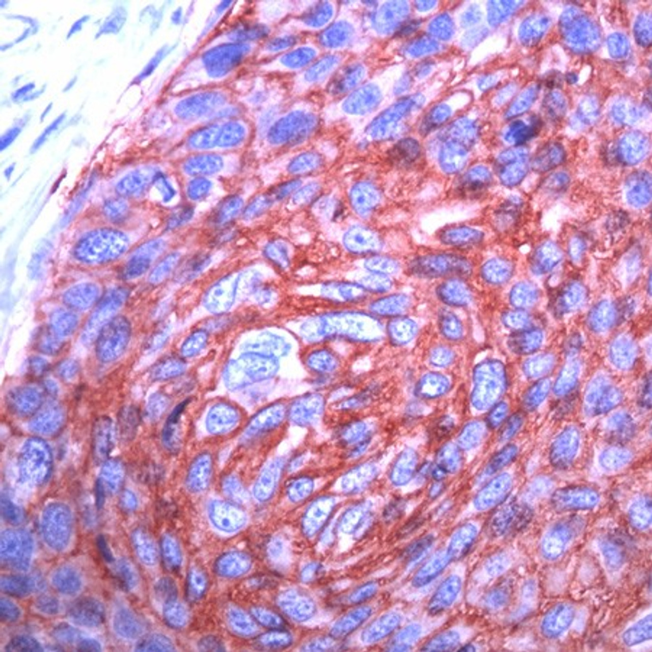 Immunohistochemistry staining of SLC2A1 in human esophagus tissue using SLC2A1 monoclonal Antibody.