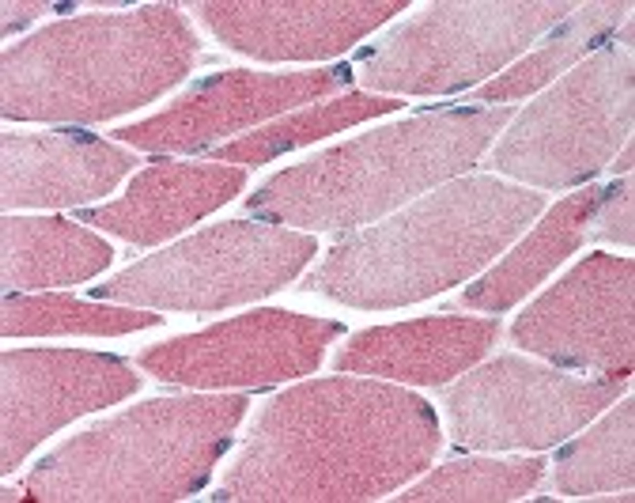 Immunohistochemistry staining of BACH1 in skeletal muscle tissue using BACH1 Antibody.