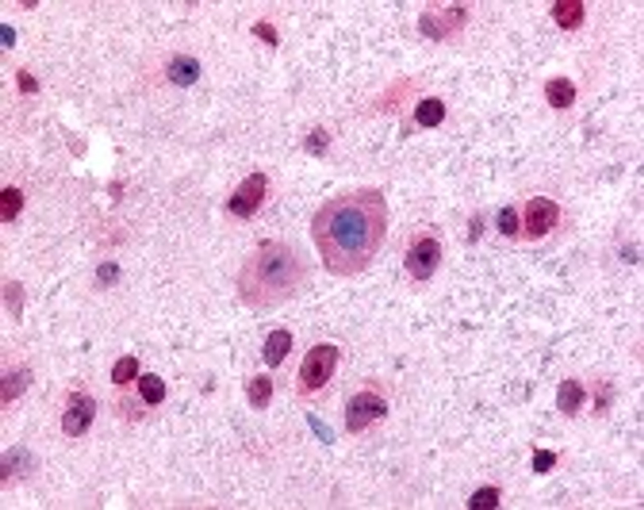 Immunohistochemistry staining of GLI2 in mouse, brain using GLI2 Antibody.