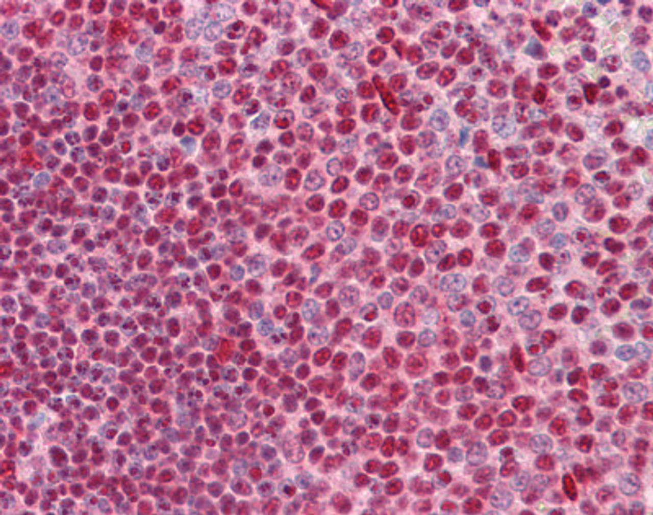Immunohistochemistry of human spleen tissue stained using CUTL1 Monoclonal Antibody.