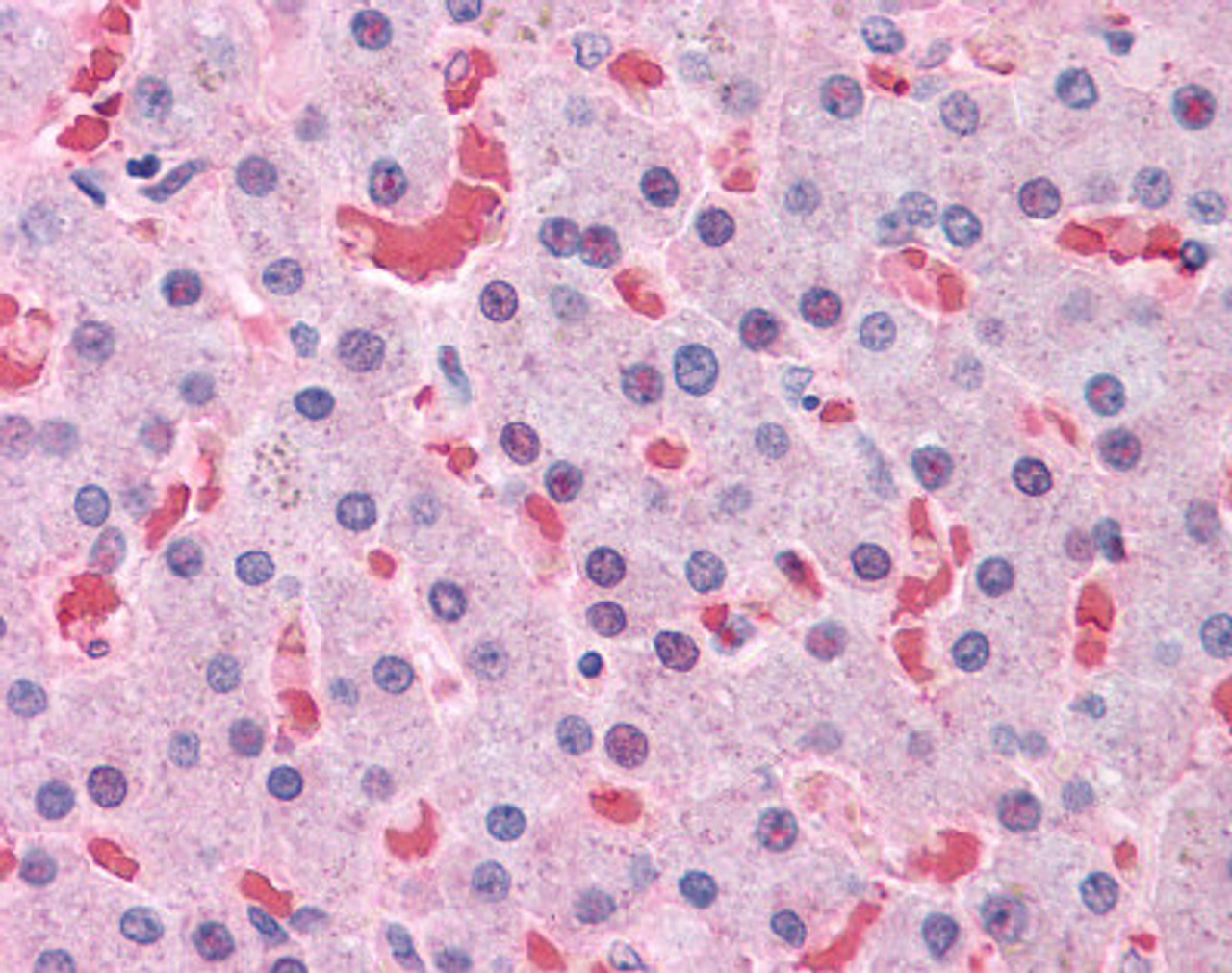 Immunohistochemistry of human liver tissue stained using HBB Monoclonal Antibody.