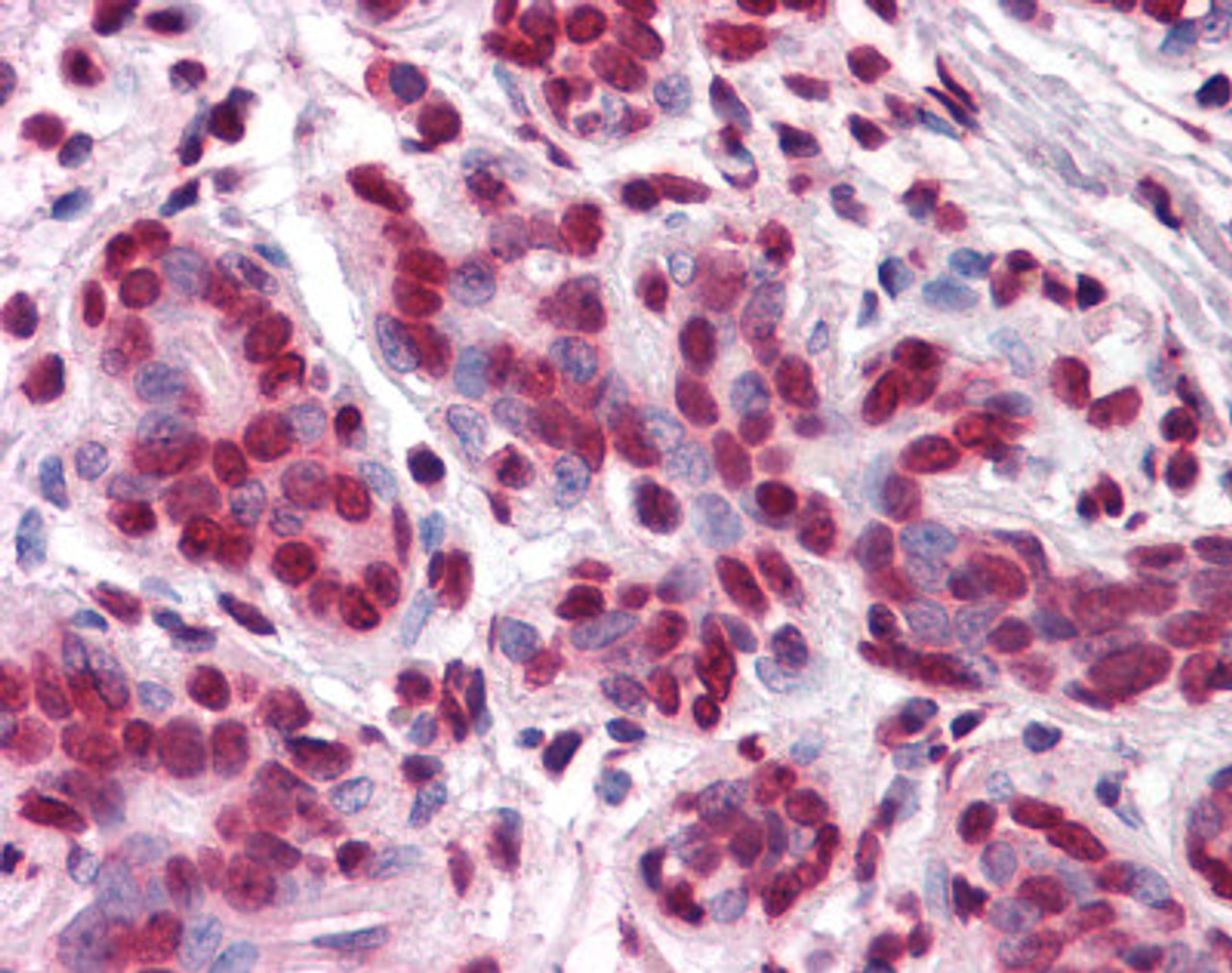 Immunohistochemistry of human breast tissue stained using VDR Monoclonal Antibody.