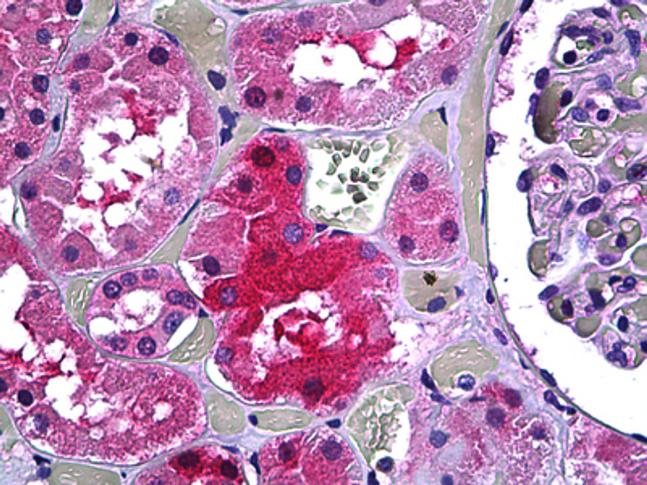 Immunohistochemistry of human kidney tubules stained using GALT Monoclonal Antibody.