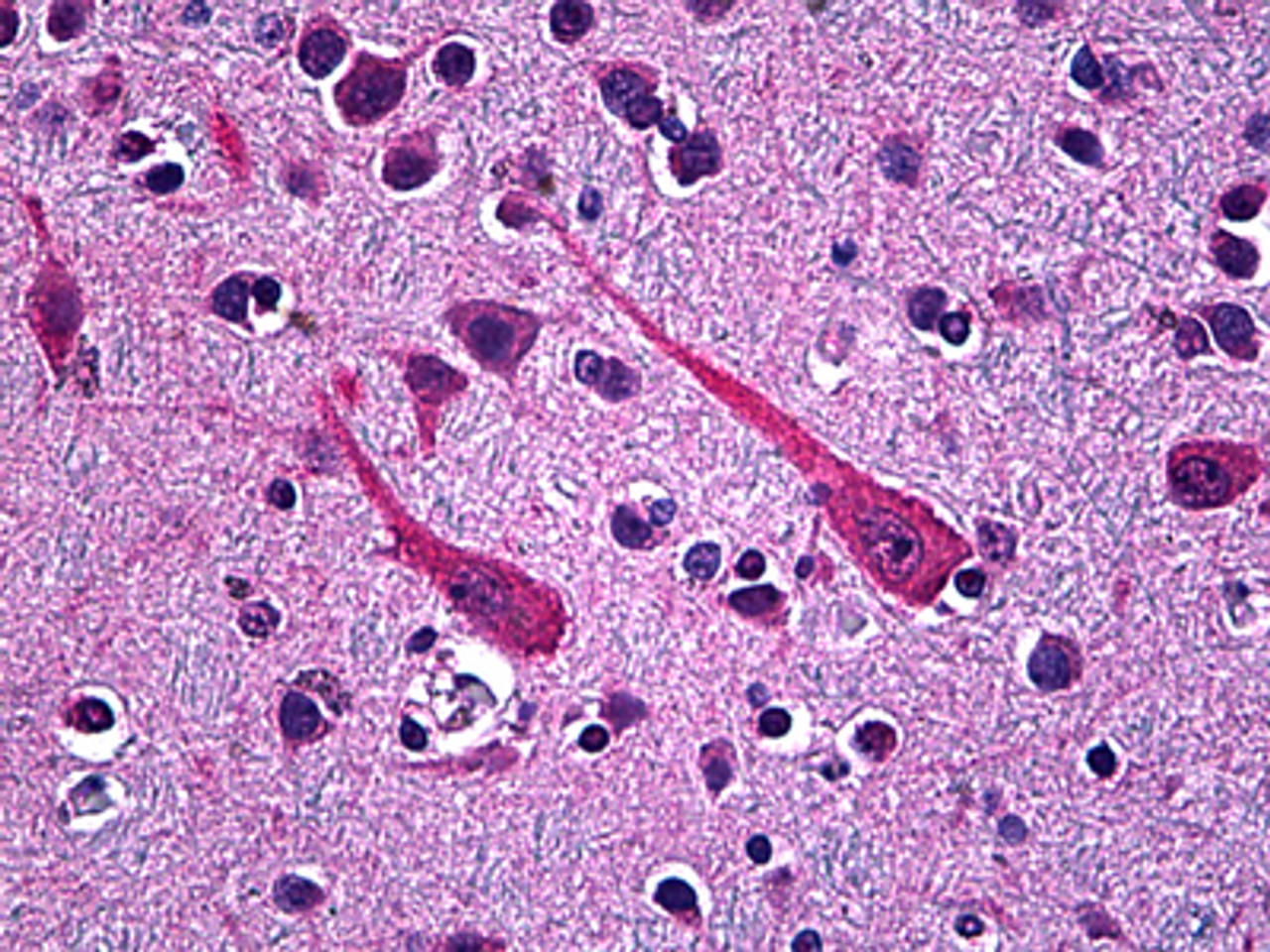 Immunohistochemistry of human brain cortex tissue stained using PCSK1 Monoclonal Antibody.