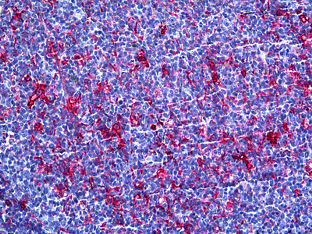 Immunohistochemistry of human tonsil tissue stained using Gelsolin Monoclonal Antibody.