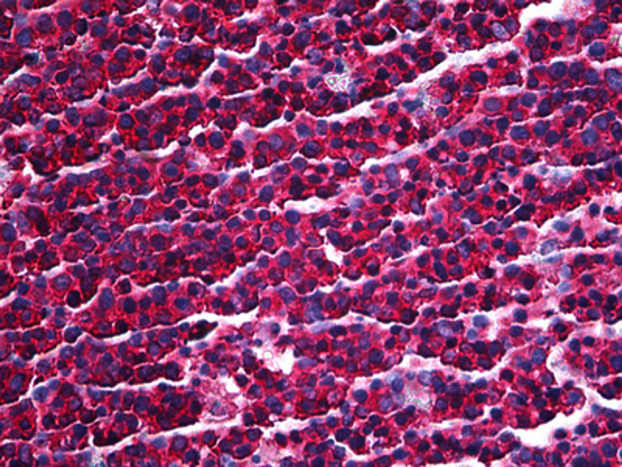 Immunohistochemistry of human tonsil tissue stained using PACT Monoclonal Antibody.