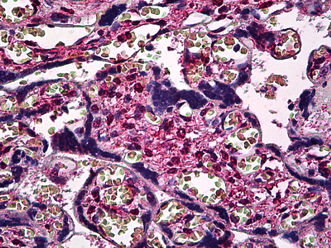 Immunohistochemistry of human placenta tissue stained using SMAD3 Monoclonal Antibody.