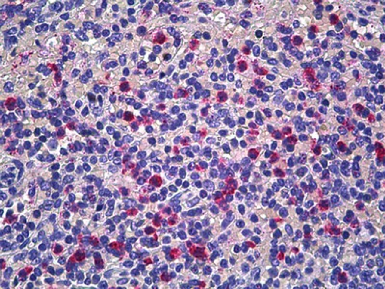 Immunohistochemistry of human spleen tissue stained using CD177 Monoclonal Antibody.