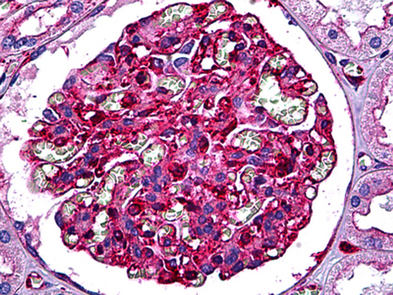 Immunohistochemistry of human kidney, Glomeruli stained using MYH9 Monoclonal Antibody.