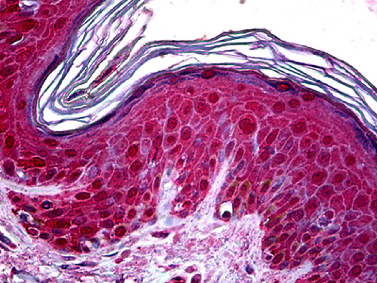 Immunohistochemistry of human skin tissue stained using TSG101 Monoclonal Antibody.