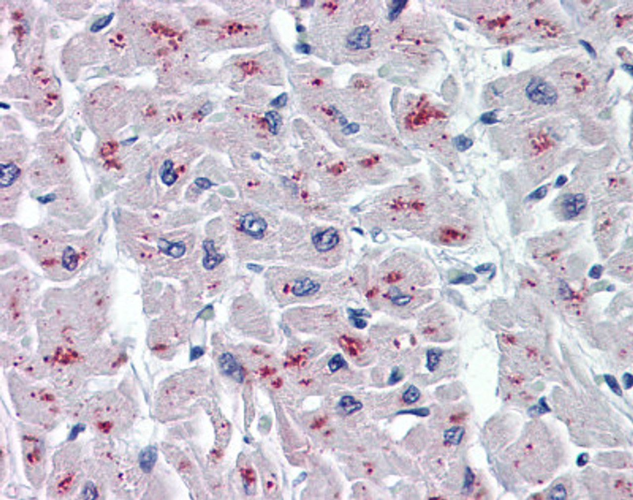 Immunohistochemistry of human heart tissue stained using ASAH1 Monoclonal Antibody.