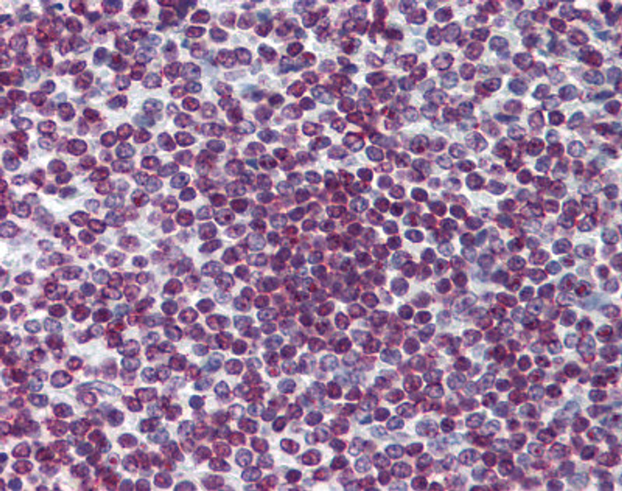 Immunohistochemistry of human spleen tissue stained using FOXO3 Monoclonal Antibody.