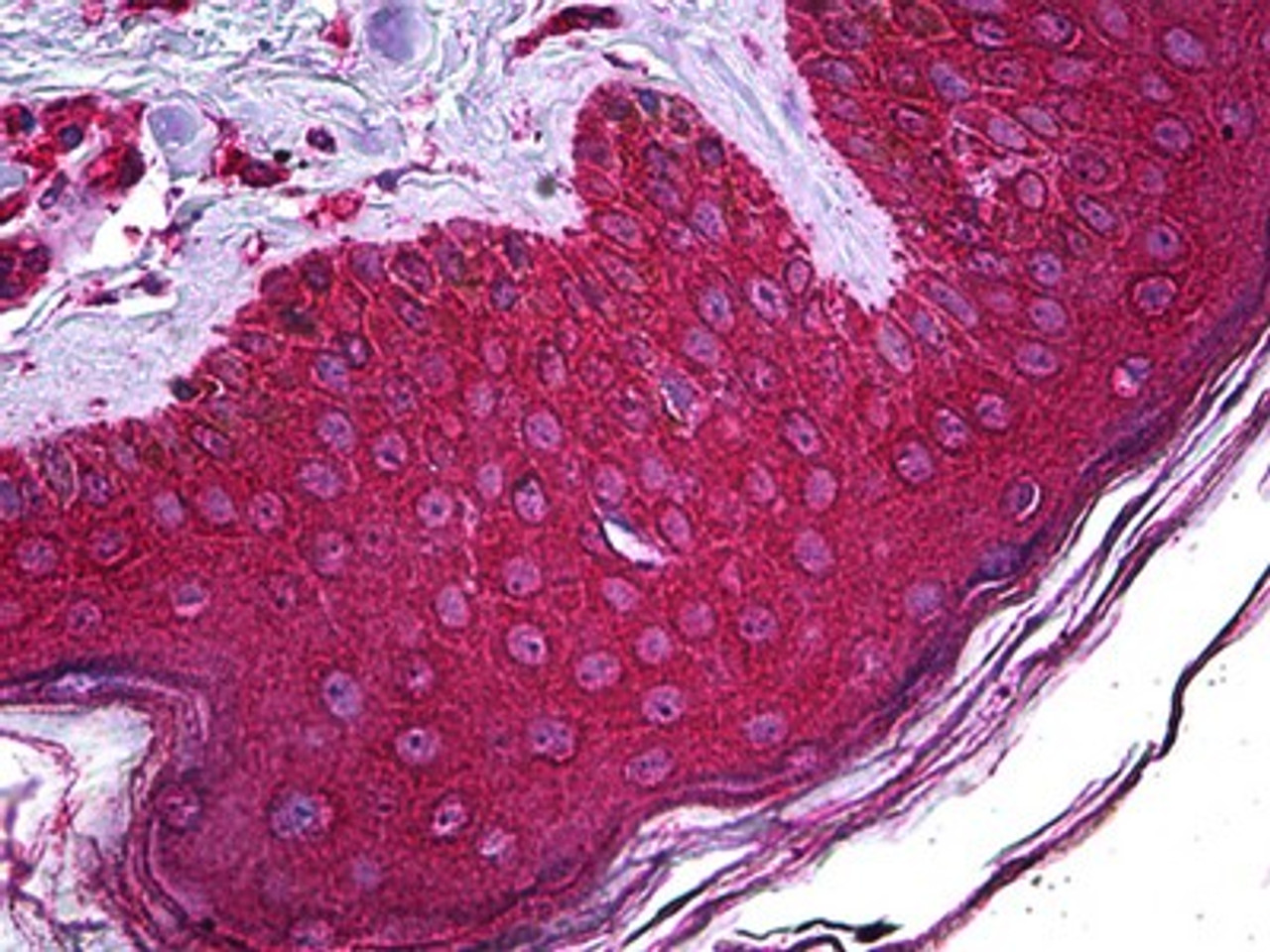 Immunohistochemistry of human skin tissue stained using ABHD5 Monoclonal Antibody.