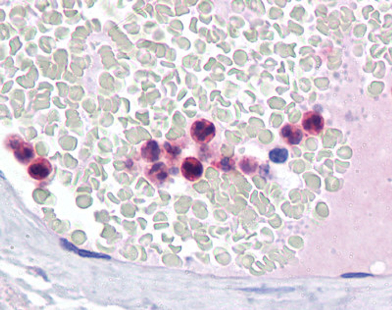 Immunohistochemistry of human Neutrophils tissue stained using IRF4 Monoclonal Antibody.