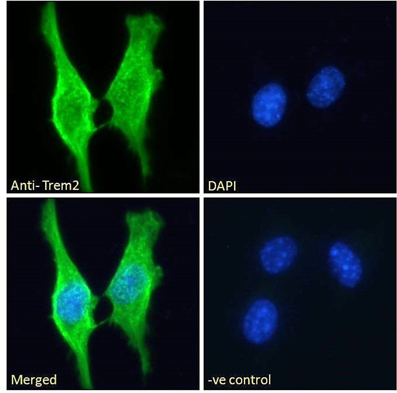 42-008 (1ug/ml) staining of Human Testis lysate (35ug protein in RIPA buffer) . Primary incubation was 1 hour. Detected by chemiluminescence.