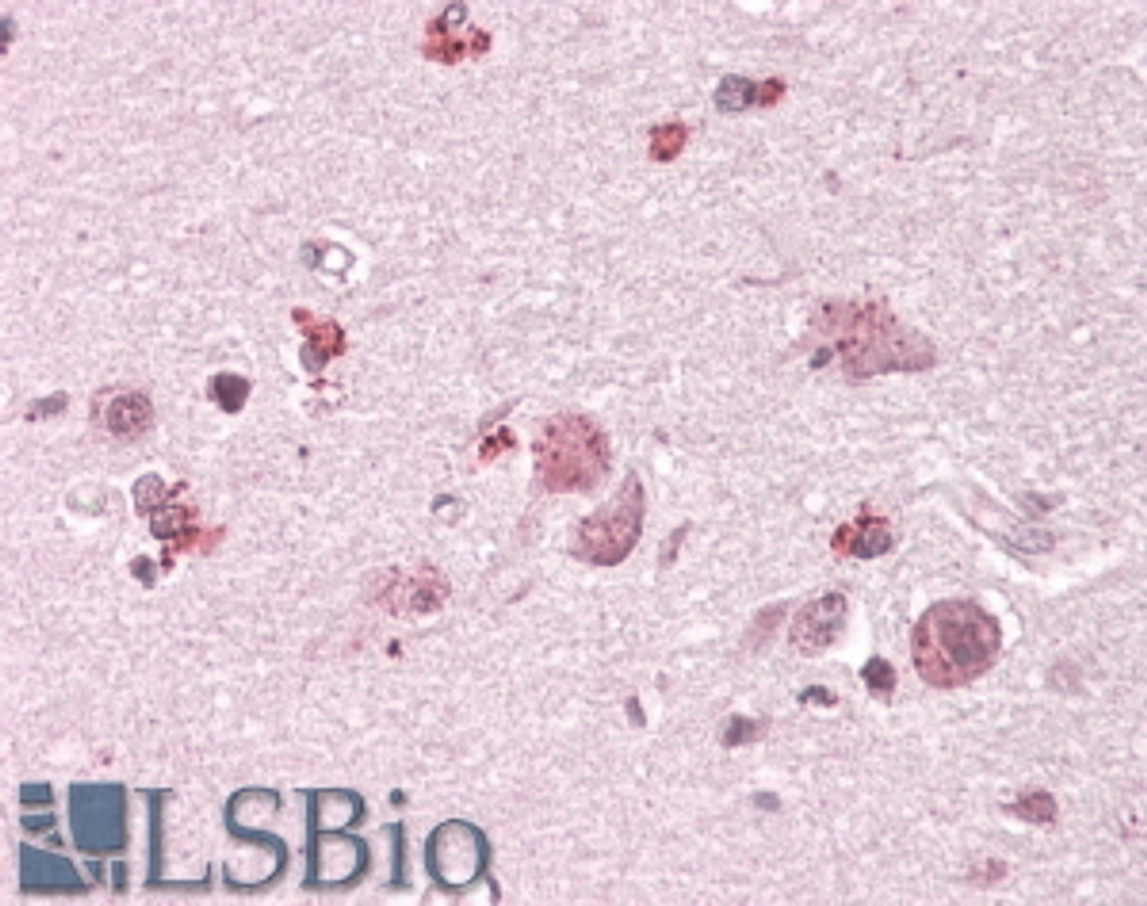 42-021 (5ug/ml) staining of paraffin embedded Human Thymus. Steamed antigen retrieval with citrate buffer pH 6, AP-staining.