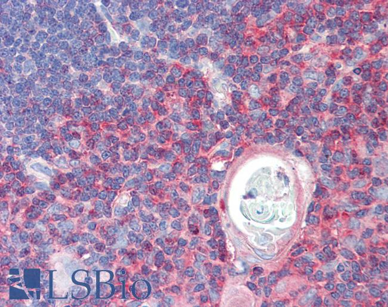 42-022 (1ug/ml) staining of Human Heart lysate (35ug protein in RIPA buffer) . Primary incubation was 1 hour. Detected by chemiluminescence.