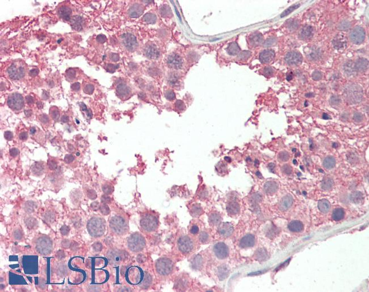 42-059 (3.8ug/ml) staining of paraffin embedded Human Liver. Steamed antigen retrieval with citrate buffer pH 6, AP-staining.