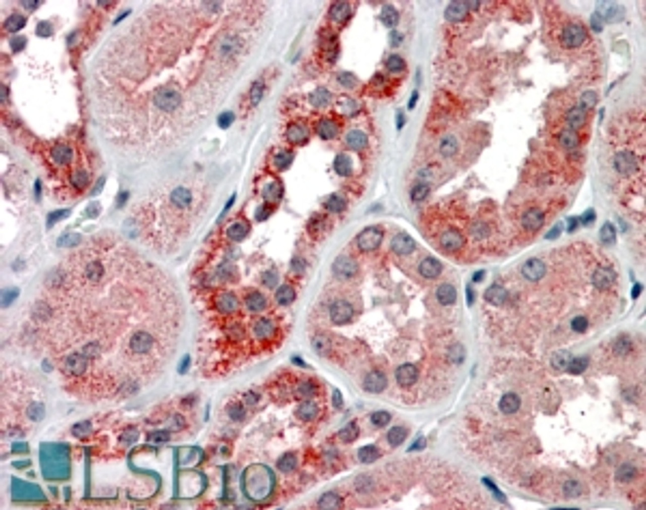 42-099 (1ug/ml) staining of Mouse Kidney (A) and Brain (B) lysate (35ug protein in RIPA buffer) . Primary incubation was 1 hour. Detected by chemiluminescence.