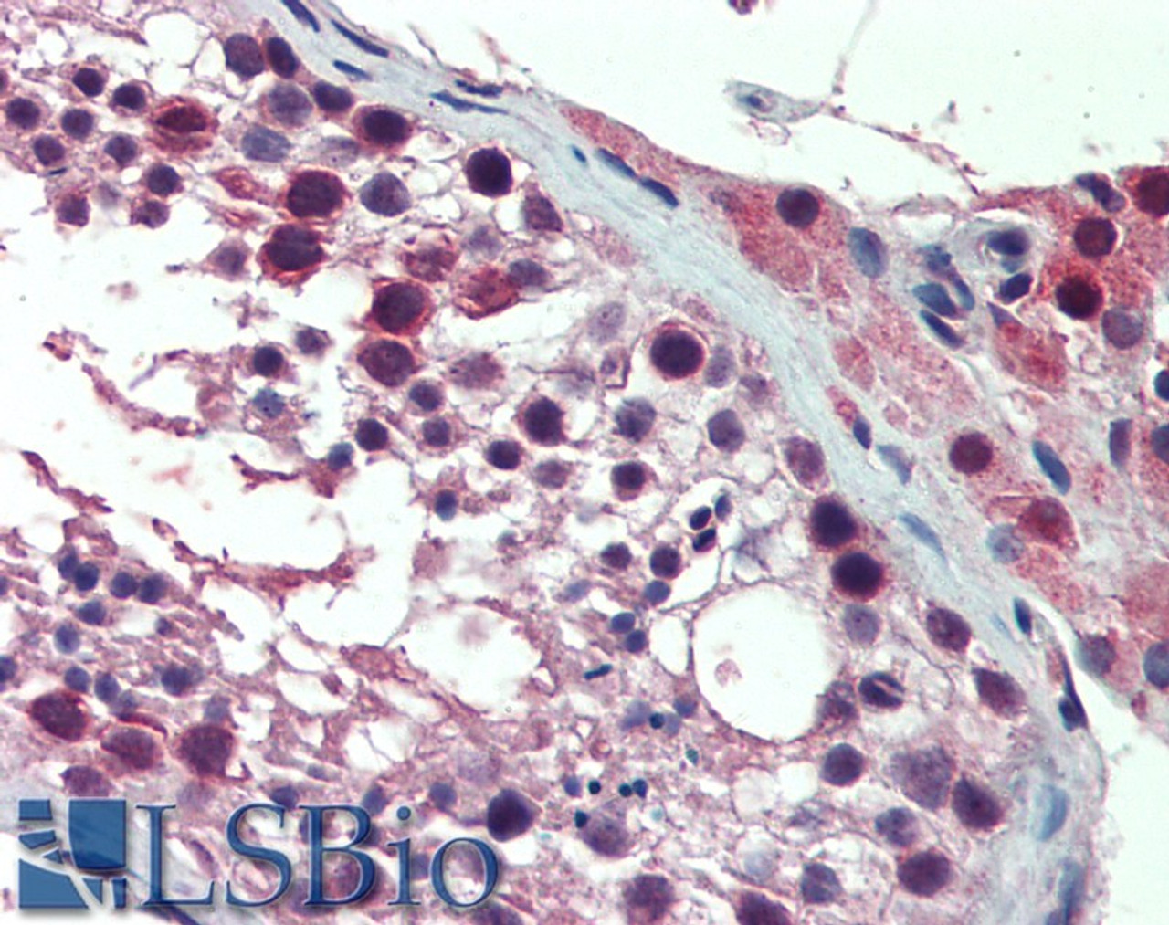 42-108 (0.3ug/ml) staining of HeLa lysate (35ug protein in RIPA buffer) . Primary incubation was 1 hour. Detected by chemiluminescence.