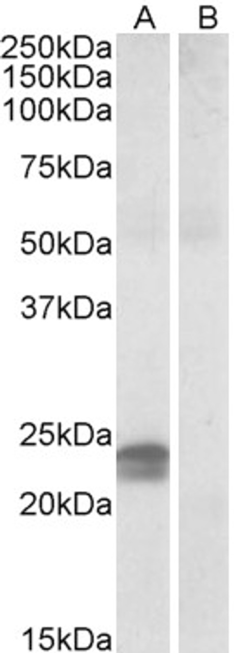 42-116 (0.03ug/ml) staining of HepG2 lysates (35ug protein in RIPA buffer) . Detected by chemiluminescence.