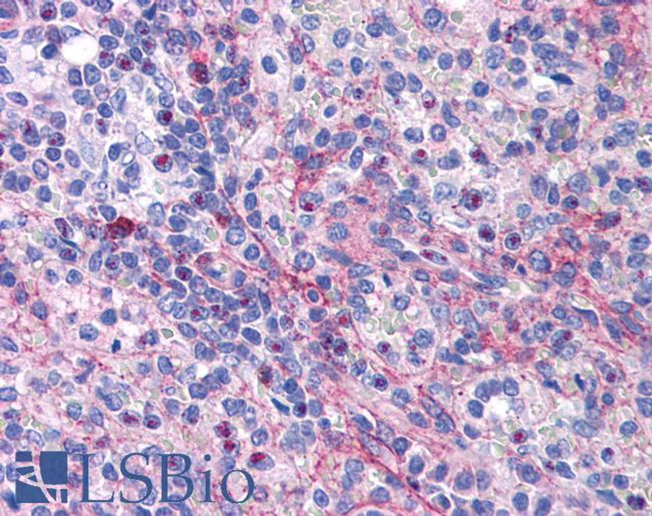 42-121 (ug/ml) staining of paraffin embedded Human Tonsil. Steamed antigen retrieval with citrate buffer pH 6, AP-staining.