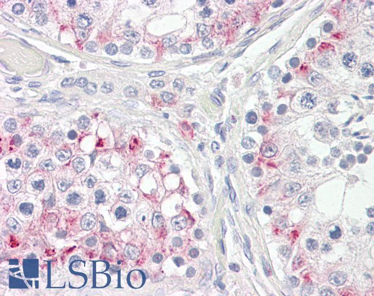 In paraffin embedded Human Placenta shows membrane staining in trophoblasts-. Recommended concentration, 2.5-3.8ug/ml.