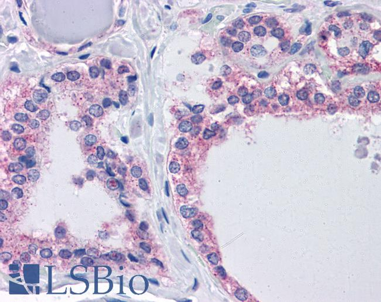 42-155 (1ug/ml) staining of Human Spleen lysate (35ug protein in RIPA buffer) . Primary incubation was 1 hour. Detected by chemiluminescence.