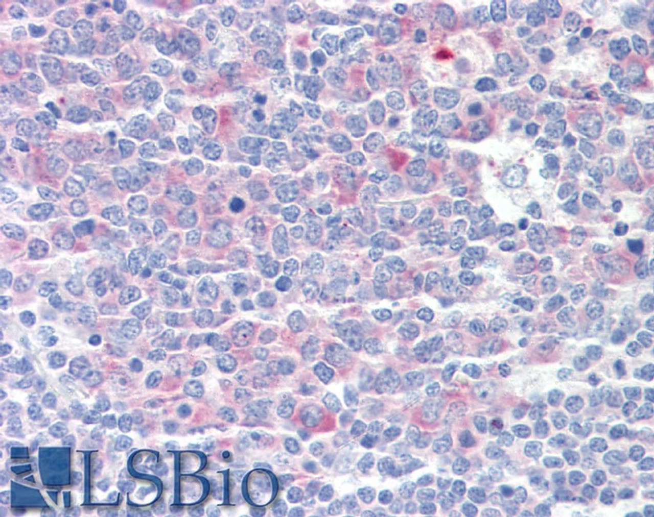 42-161 (3.75ug/ml) staining of paraffin embedded Human Adrenal Gland. Steamed antigen retrieval with citrate buffer pH 6, AP-staining.