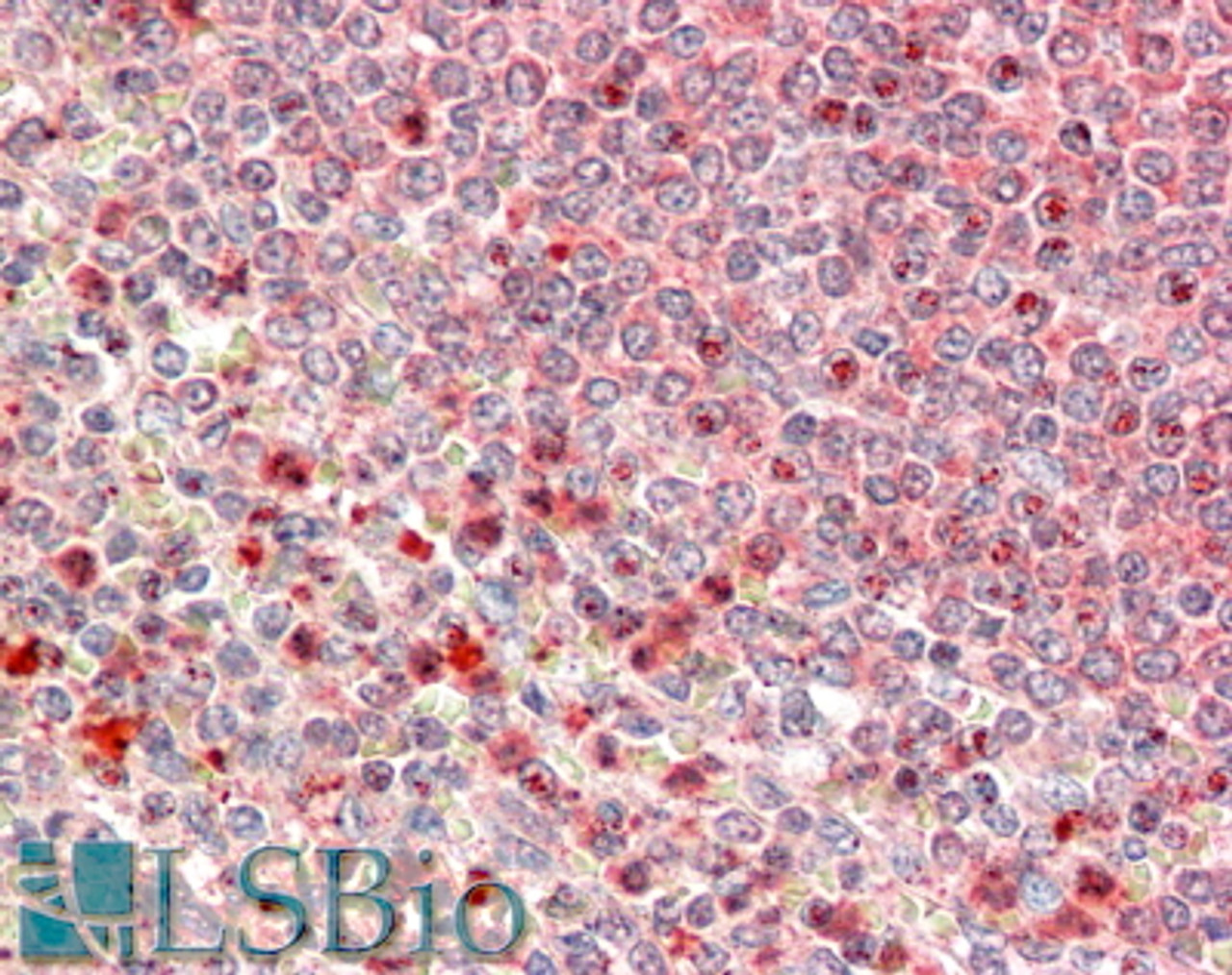 42-178 (0.3ug/ml) staining of Mouse Ovary (A) and Rat Uterus (B) lysate (35ug protein in RIPA buffer) . Detected by chemiluminescence.